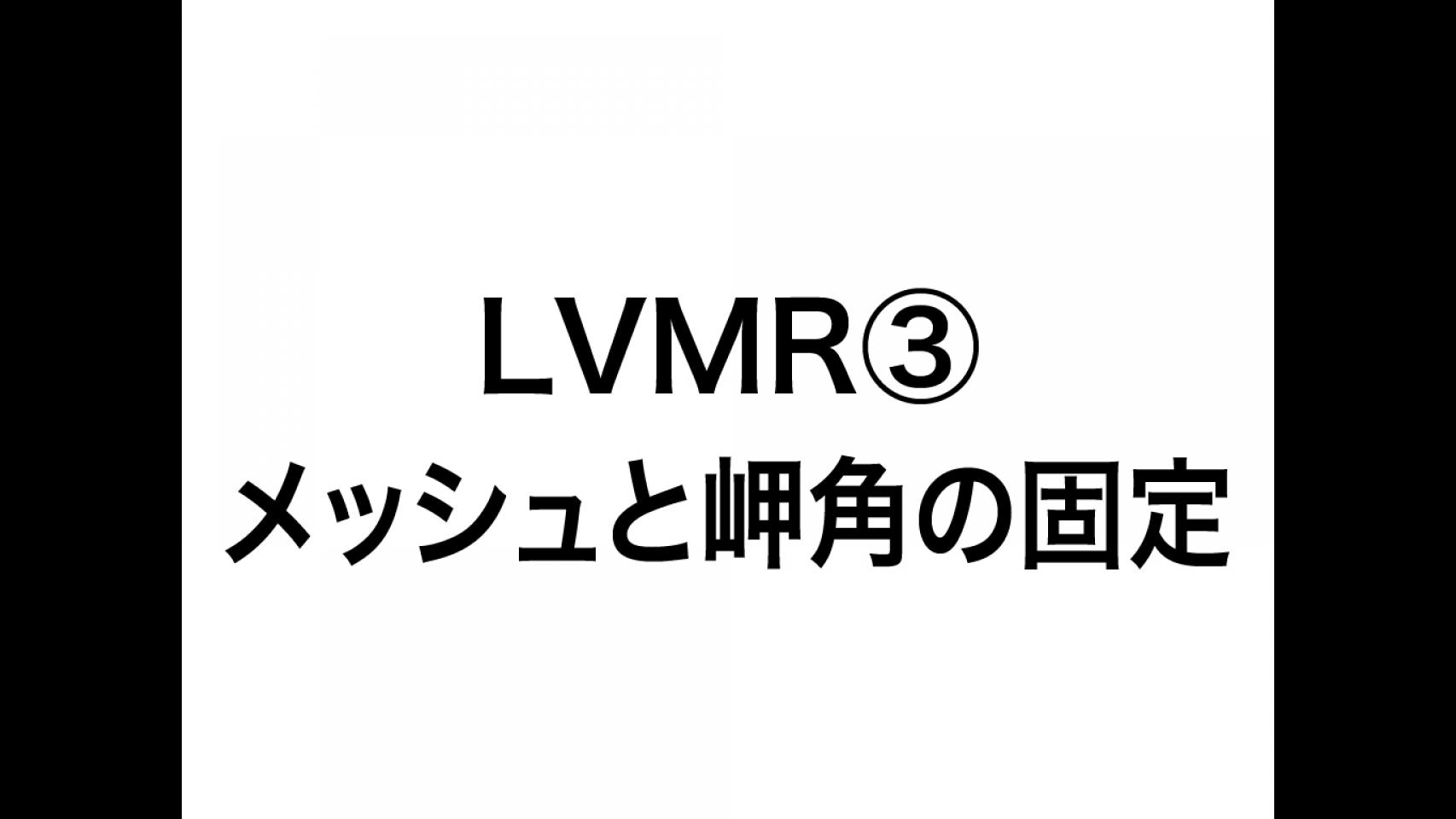 動画6.LVMR③メッシュと岬角の固定