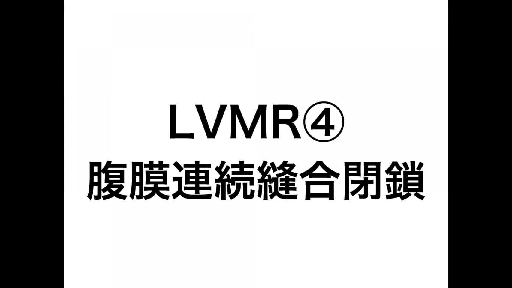 動画7.LVMR④腹膜連続縫合閉鎖